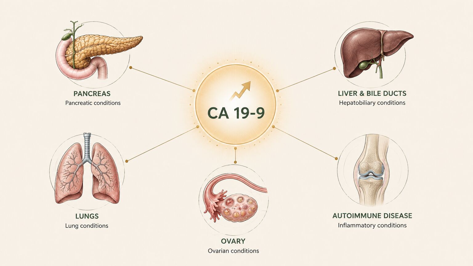 Scientific illustration of a single elevated CA 19-9 signal branching out to icons of the pancreas, liver, bile ducts, lungs, and ovaries