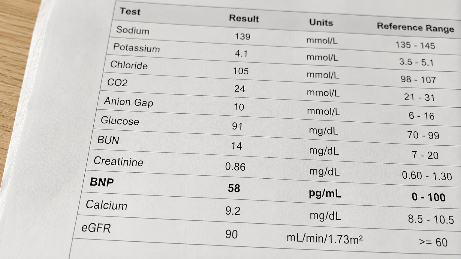 Close-up of a printed lab report showing a BNP result comfortably within its normal reference range