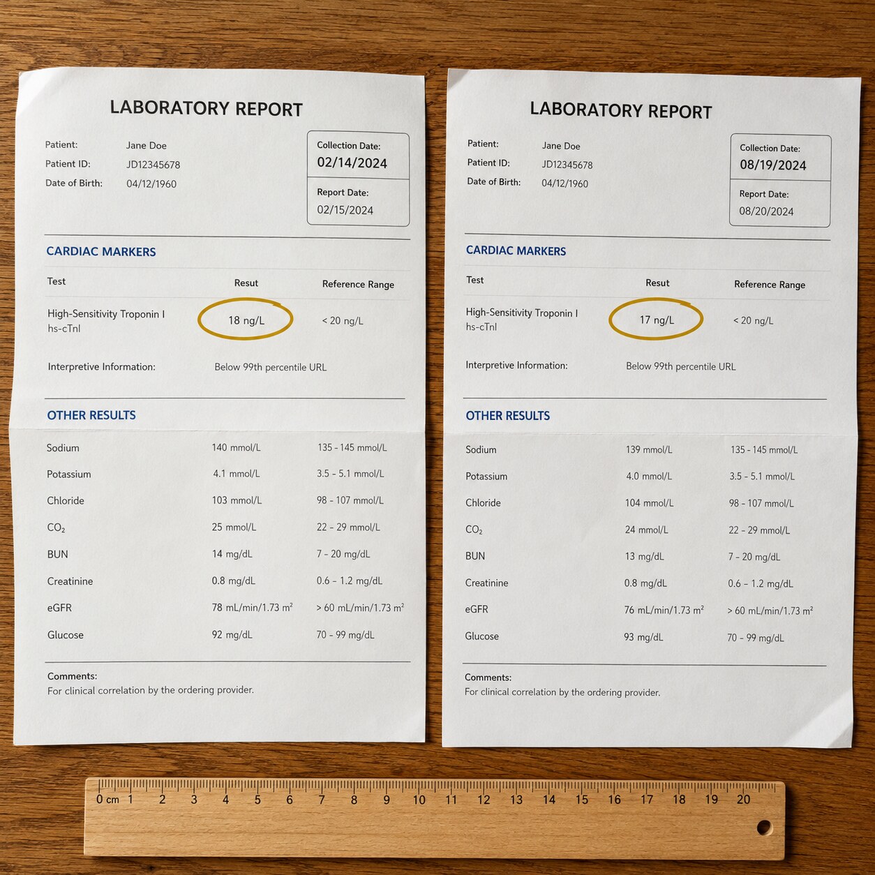 Two dated troponin lab reports placed side by side with the circled values showing a flat, unchanged trend between draws