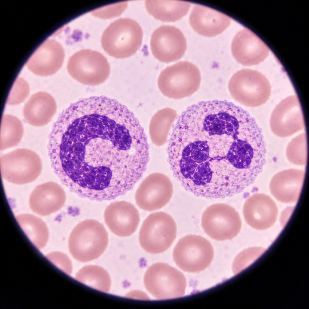 Microscope view of a band neutrophil with a horseshoe nucleus beside a mature segmented neutrophil