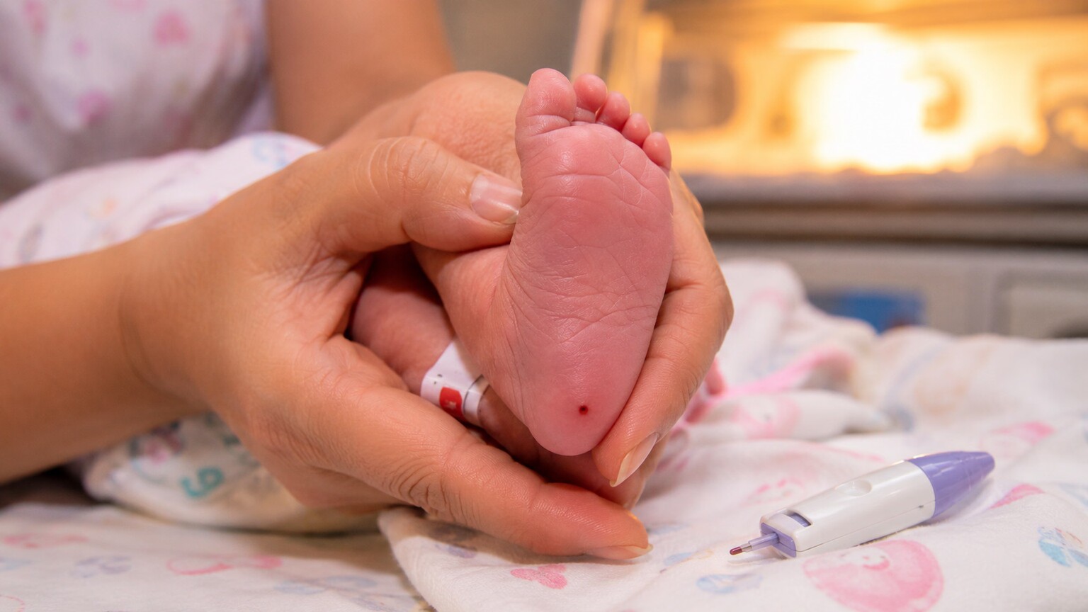 A newborn infant's foot being gently held during a routine heel-prick blood draw in a hospital nursery