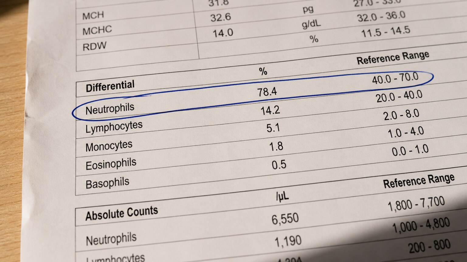 Close-up of a printed complete blood count differential with the neutrophil percentage circled in ink above the reference range
