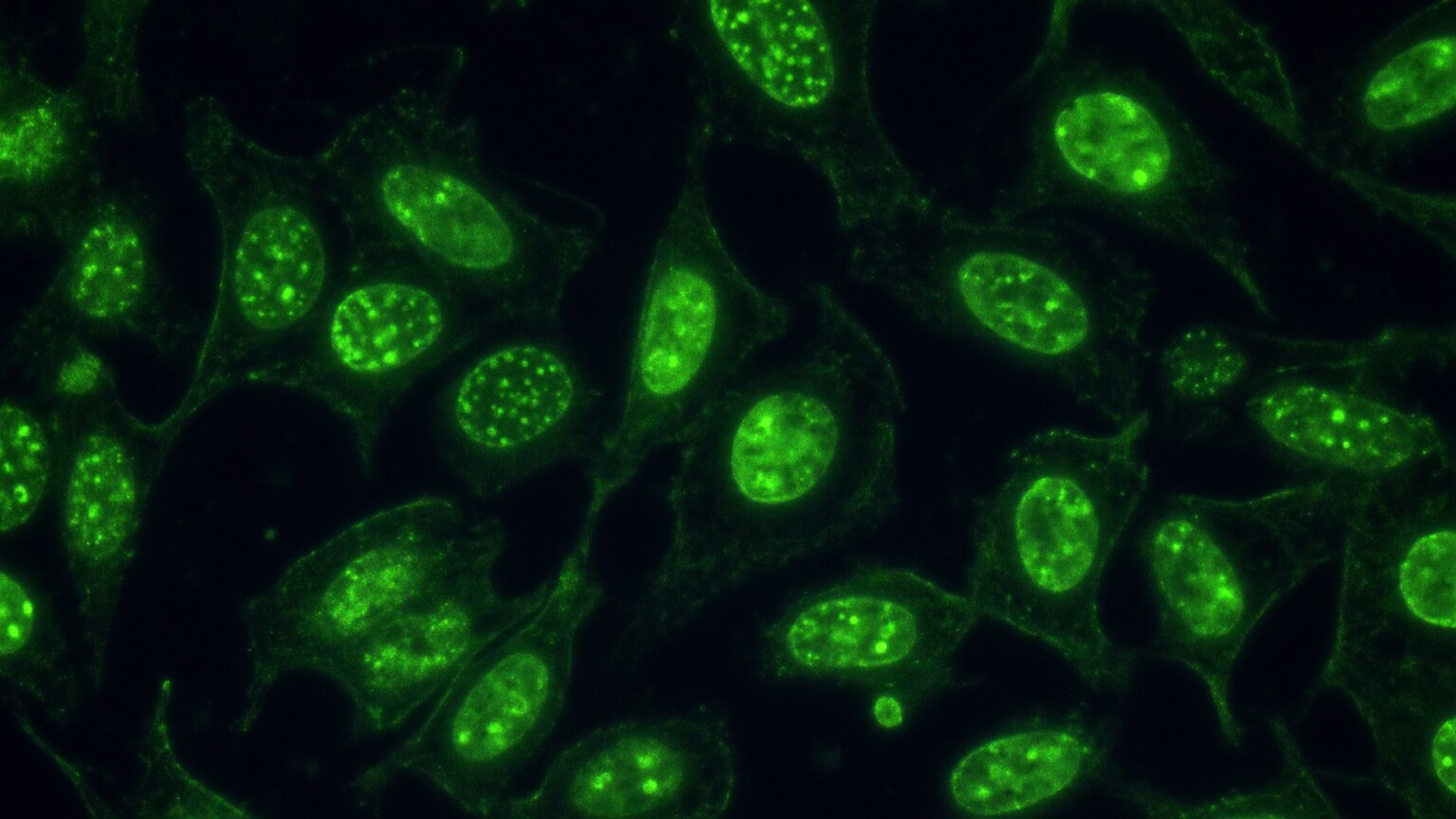 Scientific illustration of human cells viewed through a fluorescence microscope showing glowing green antibody staining within the cell nuclei