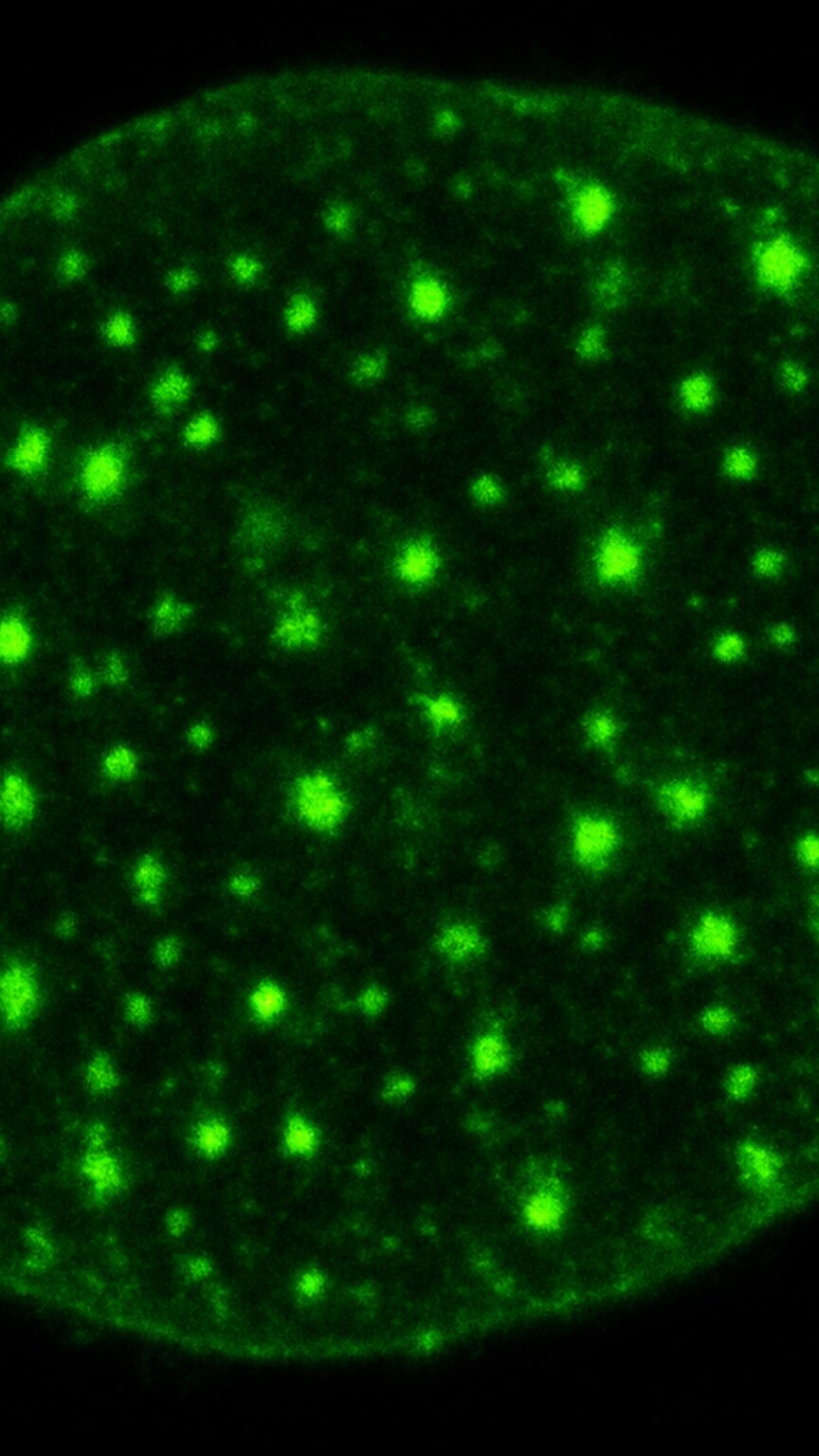 Scientific illustration of a cell nucleus showing numerous small, scattered glowing dots throughout its interior, representing the speckled ANA staining pattern