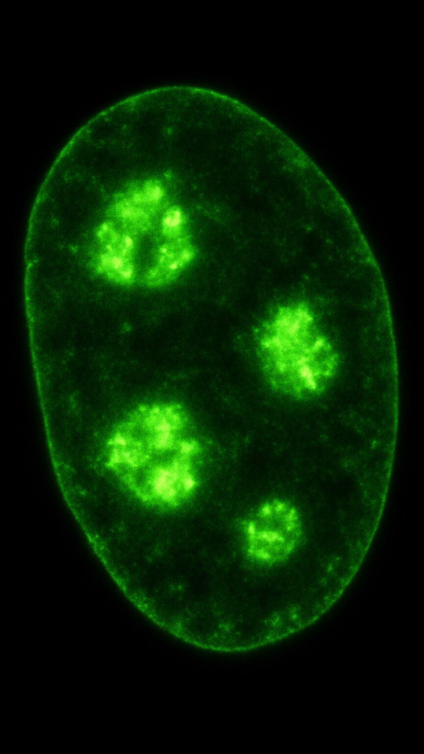 Scientific illustration of a cell nucleus showing a small number of large, distinct glowing clustered regions, representing the nucleolar ANA staining pattern