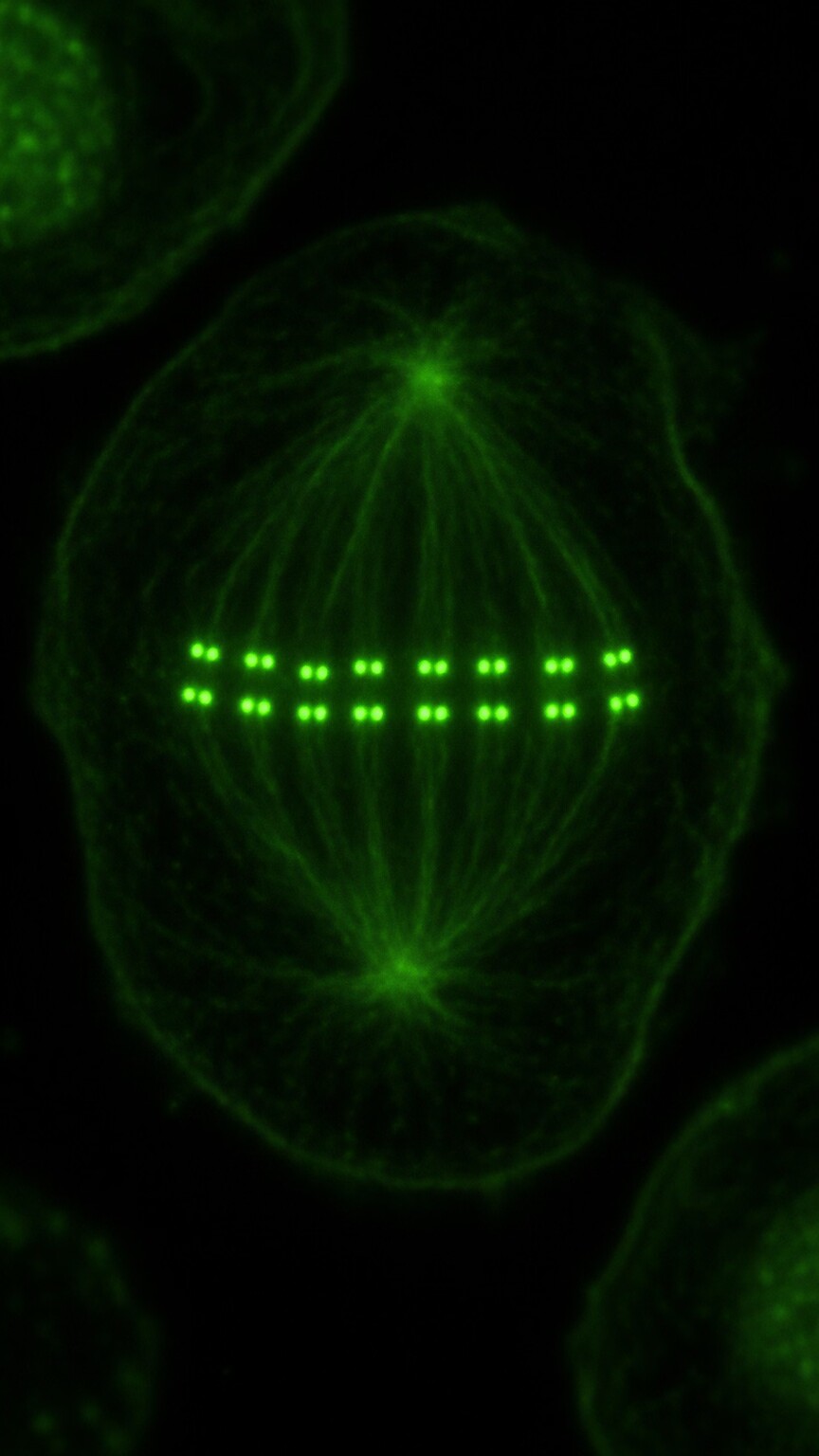 Scientific illustration of a dividing cell showing a distinctive row of small paired glowing dots aligned along the chromosomes, representing the centromere ANA staining pattern
