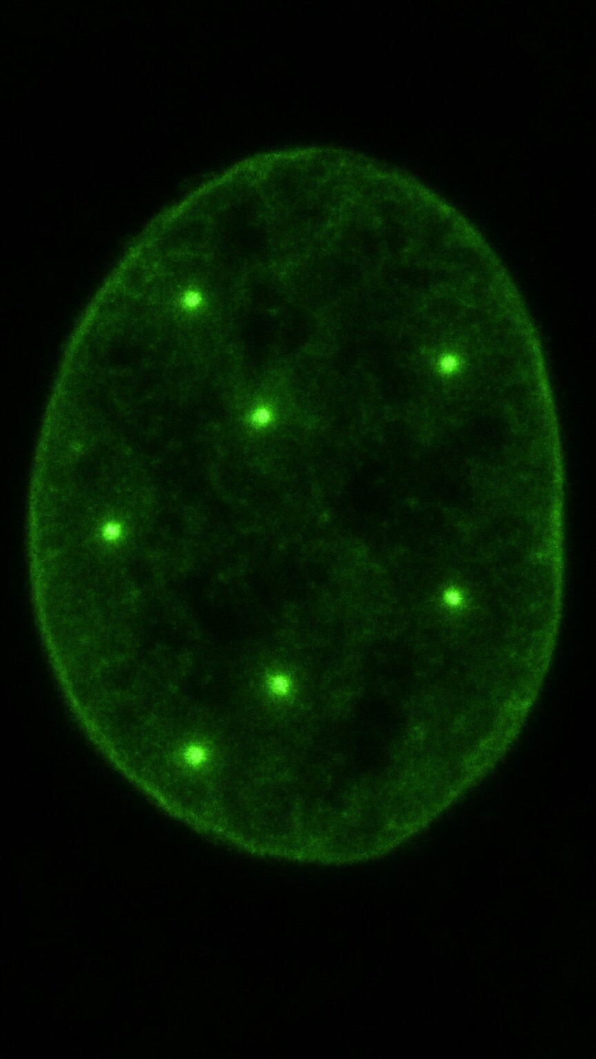 Scientific illustration of a cell nucleus showing only a small handful of well-separated, discrete glowing dots, representing the nuclear dot ANA staining pattern