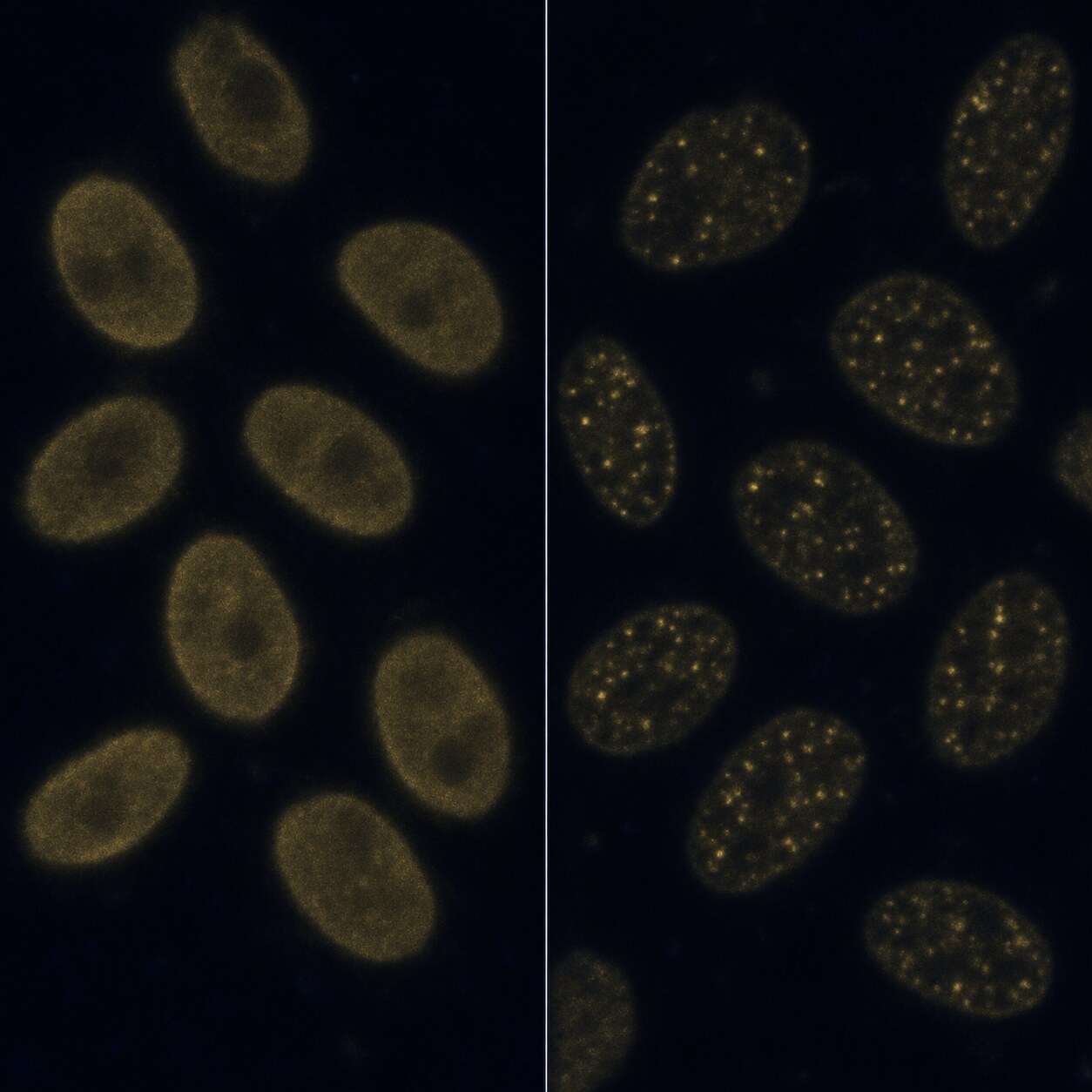 Microscope comparison of a faint homogeneous immunofluorescence staining pattern beside a faint speckled pattern on cell nuclei