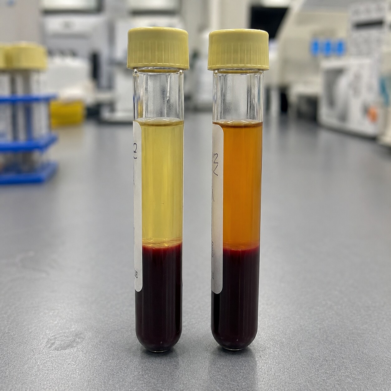 Side-by-side blood sample tubes illustrating darker, more concentrated blood plasma from dehydration versus normally hydrated plasma