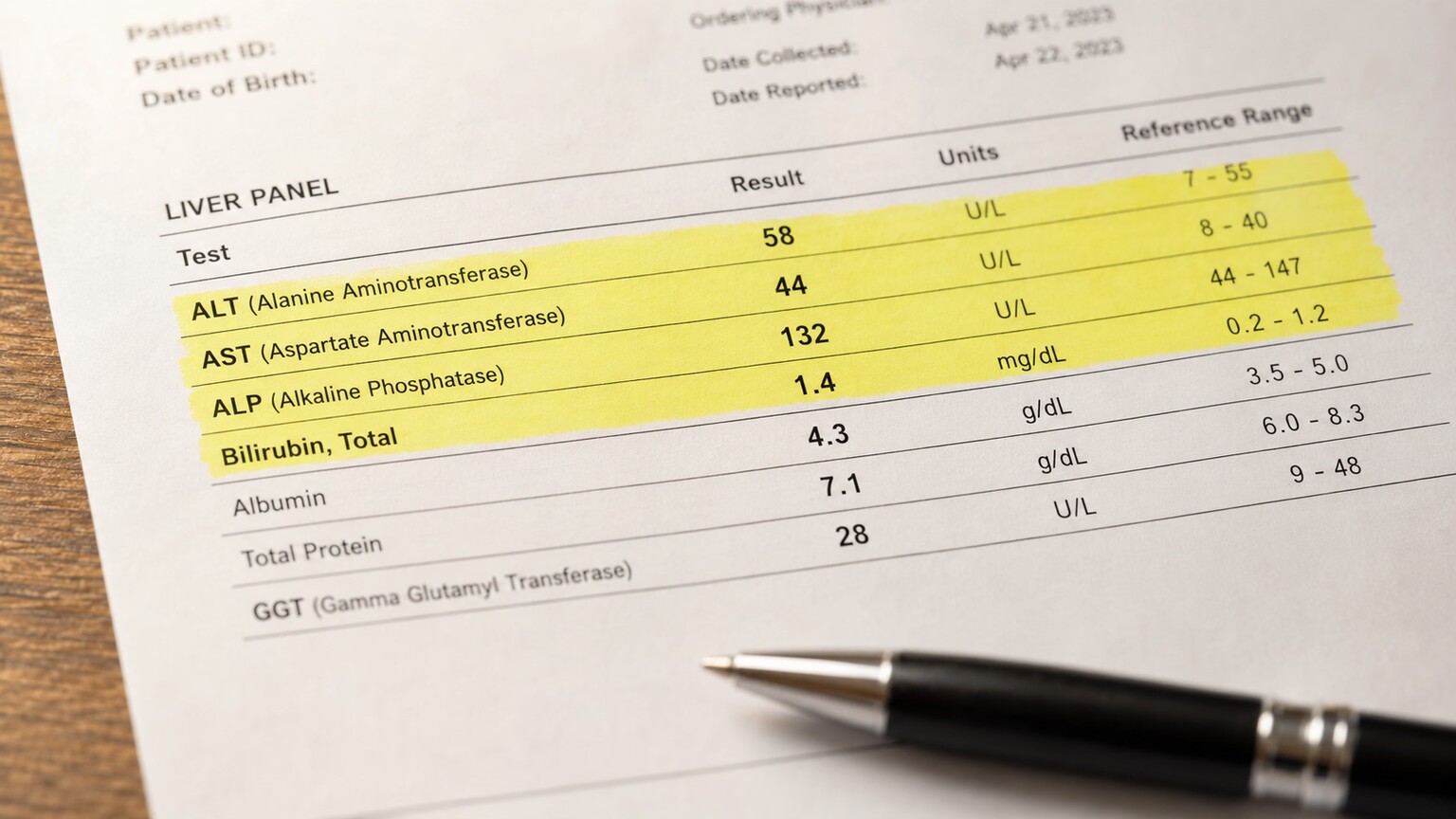 Close-up of a printed liver panel lab report showing ALT, AST, ALP, and bilirubin rows together, with several values highlighted for comparison