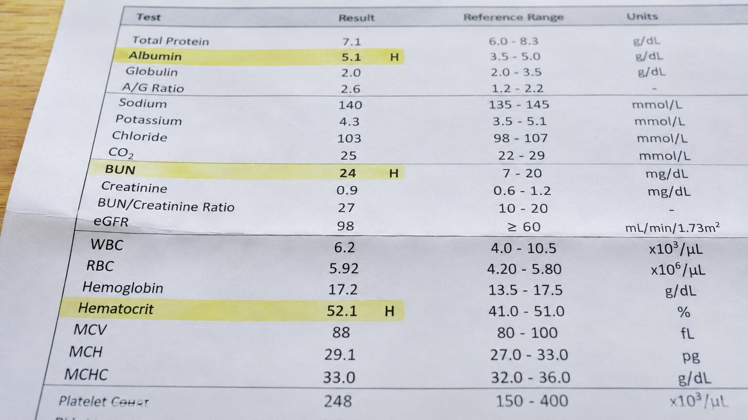 Close-up of a printed lab report showing albumin, BUN, and hematocrit all flagged above their reference ranges on the same panel