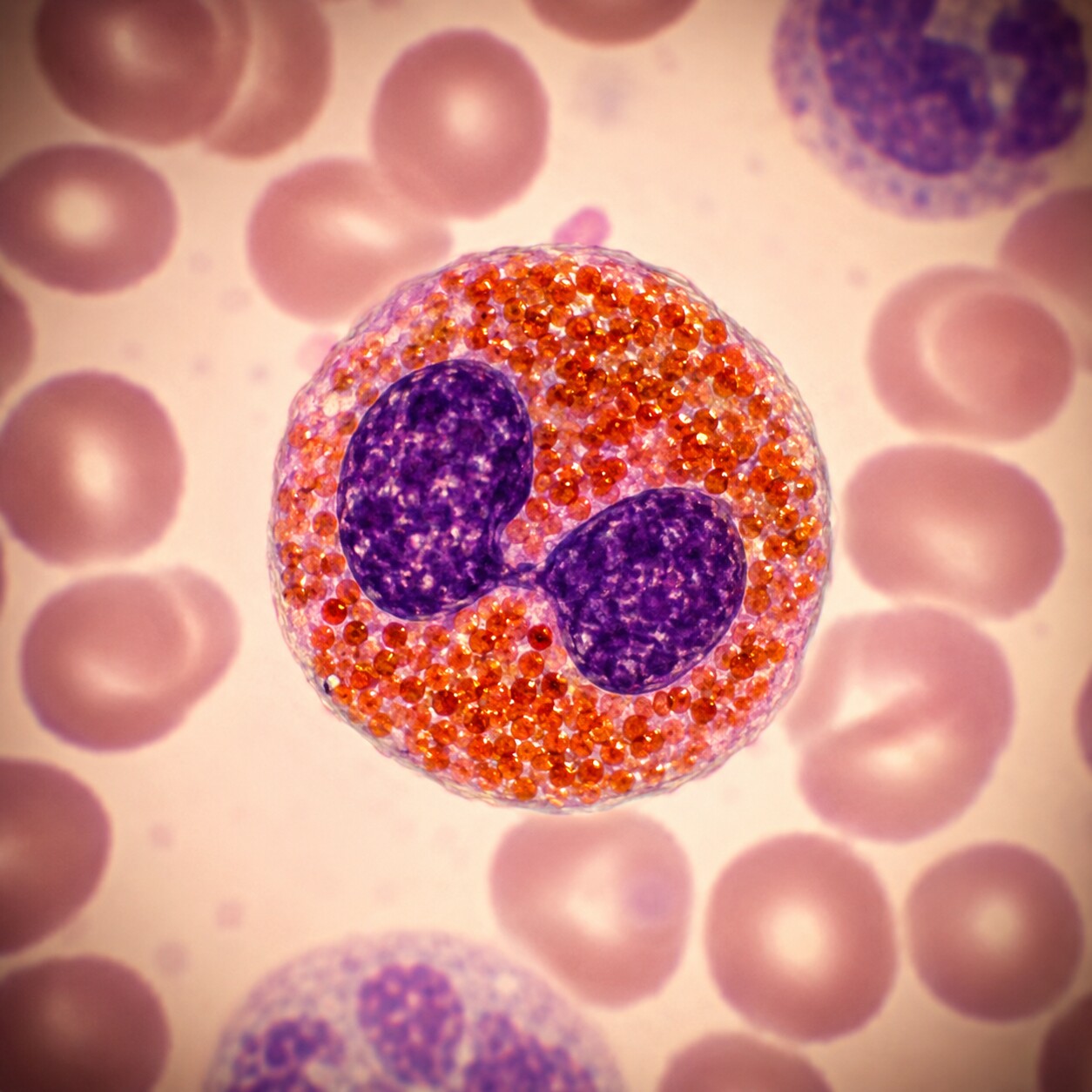 High-magnification microscopy image of a single eosinophil white blood cell with orange-red cytoplasmic granules and a bilobed nucleus