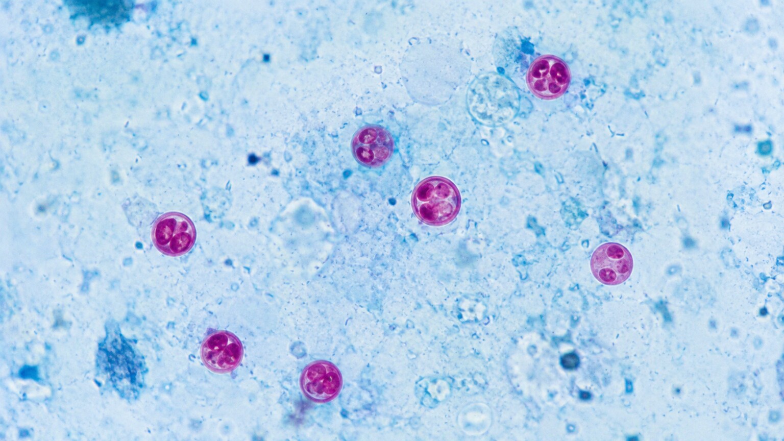 Microscopic view of Cryptosporidium oocysts stained pink under acid-fast staining in a stool sample