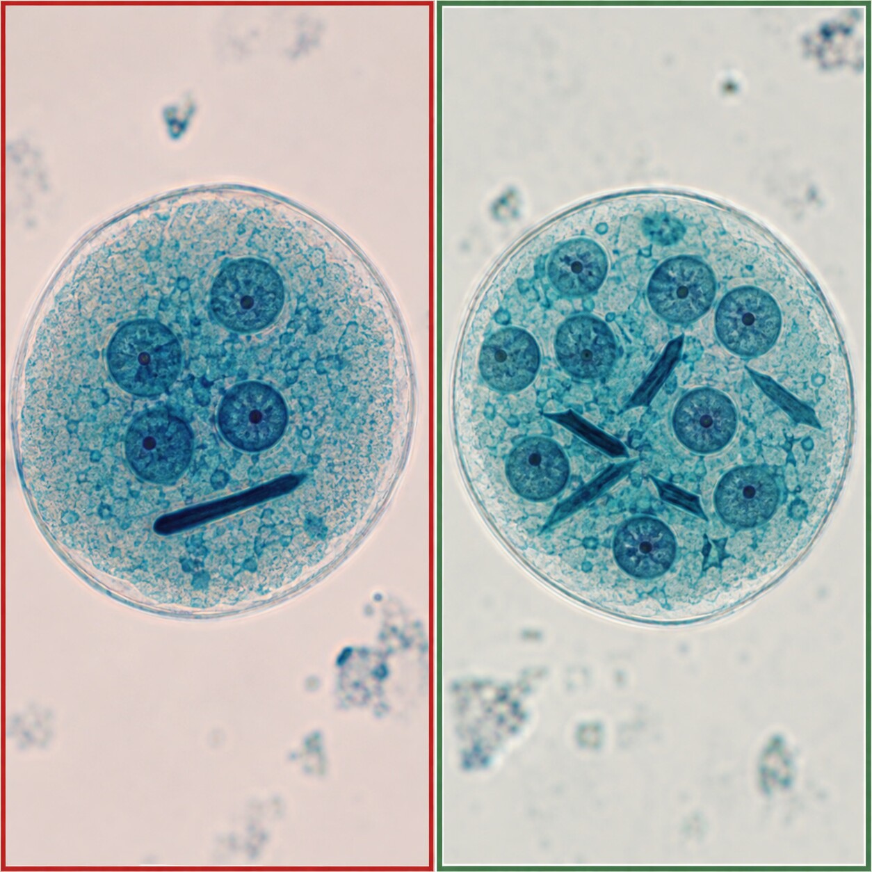 Side-by-side scientific illustration comparing pathogenic Entamoeba histolytica cysts and harmless Entamoeba coli cysts