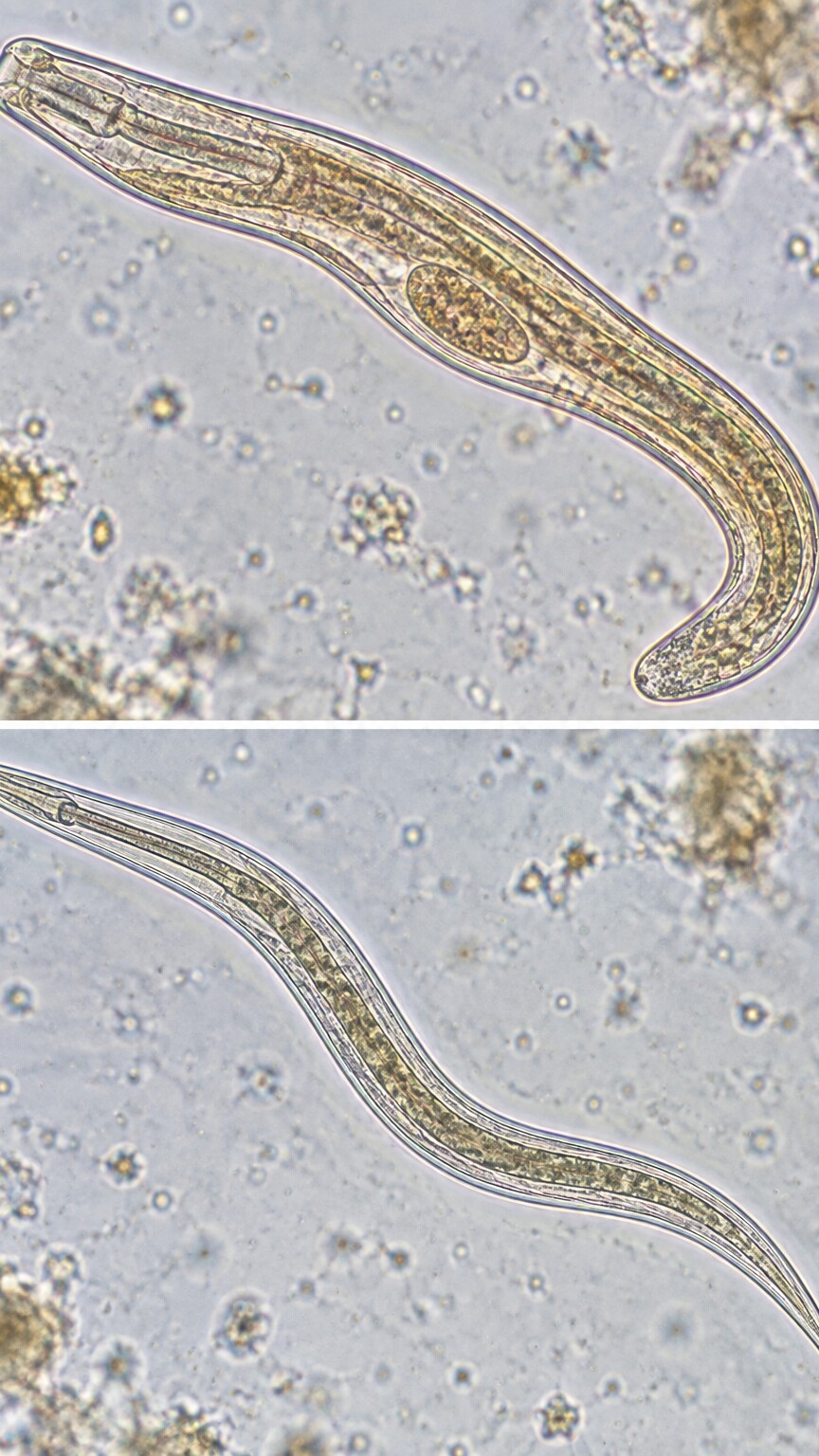 Side-by-side microscopic comparison of a short-buccal-cavity rhabditiform larva and a longer filariform larva