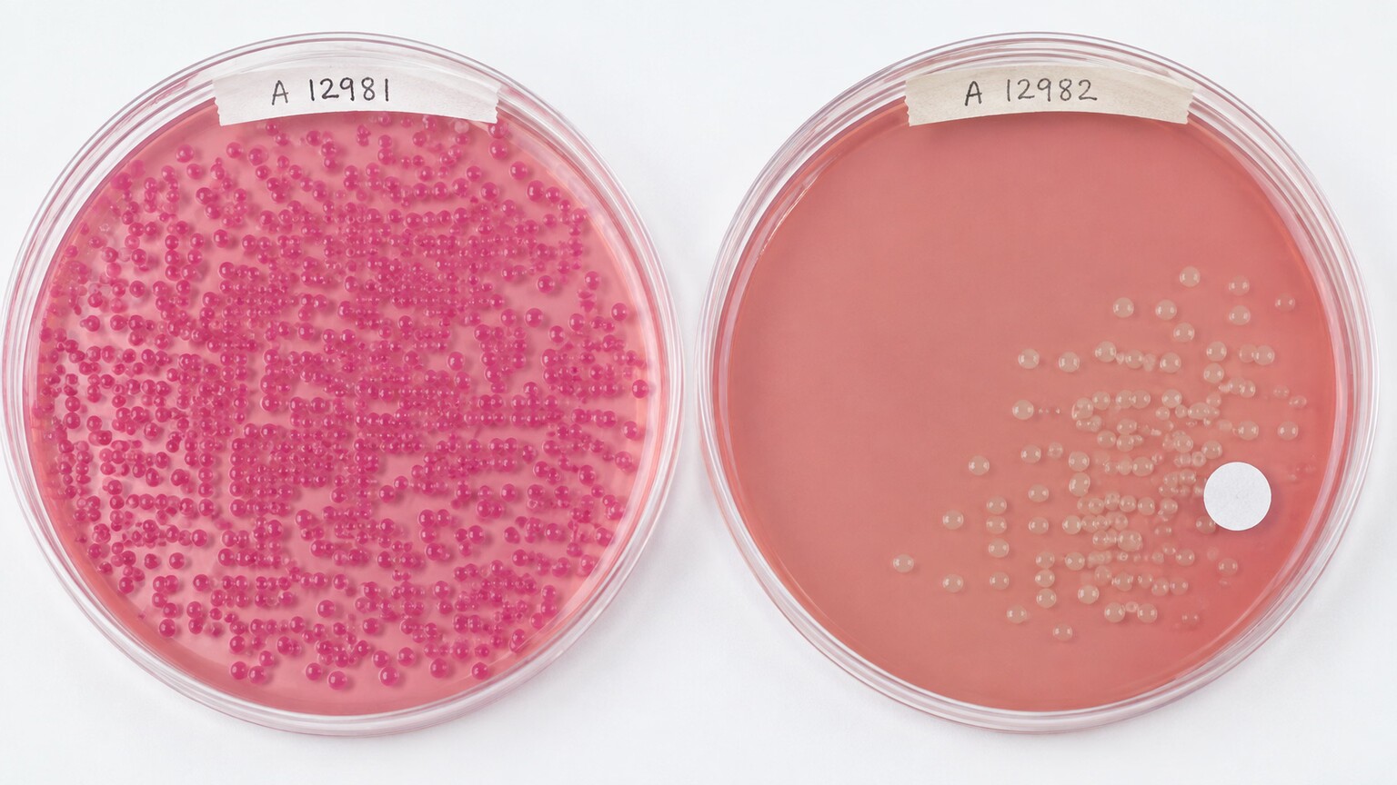 Side-by-side sorbitol-MacConkey agar plates comparing pink normal E. coli colonies against pale colonies flagged as possible E. coli O157:H7