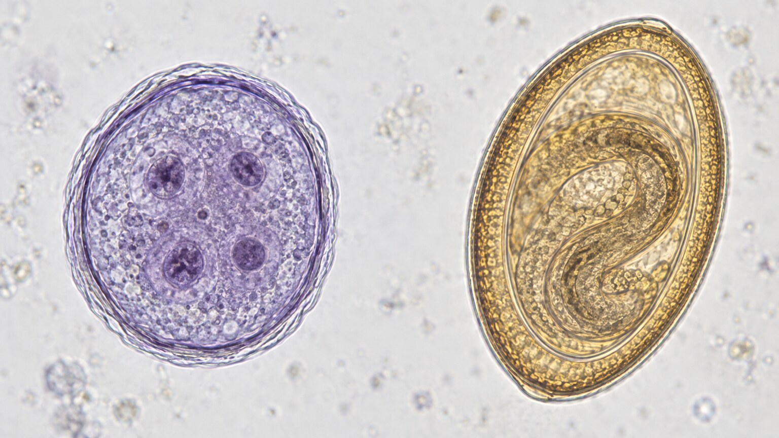 Side-by-side comparison of a protozoal cyst structure and a helminth egg as seen under microscopic examination