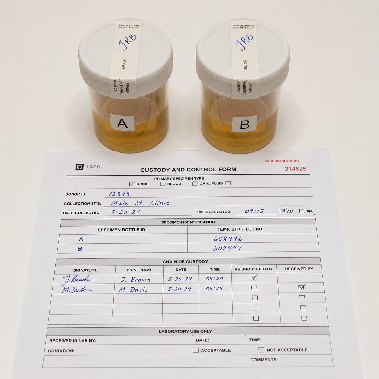 Two separate sealed specimen bottles labeled A and B, both filled from a single urine collection and prepared for split-specimen testing