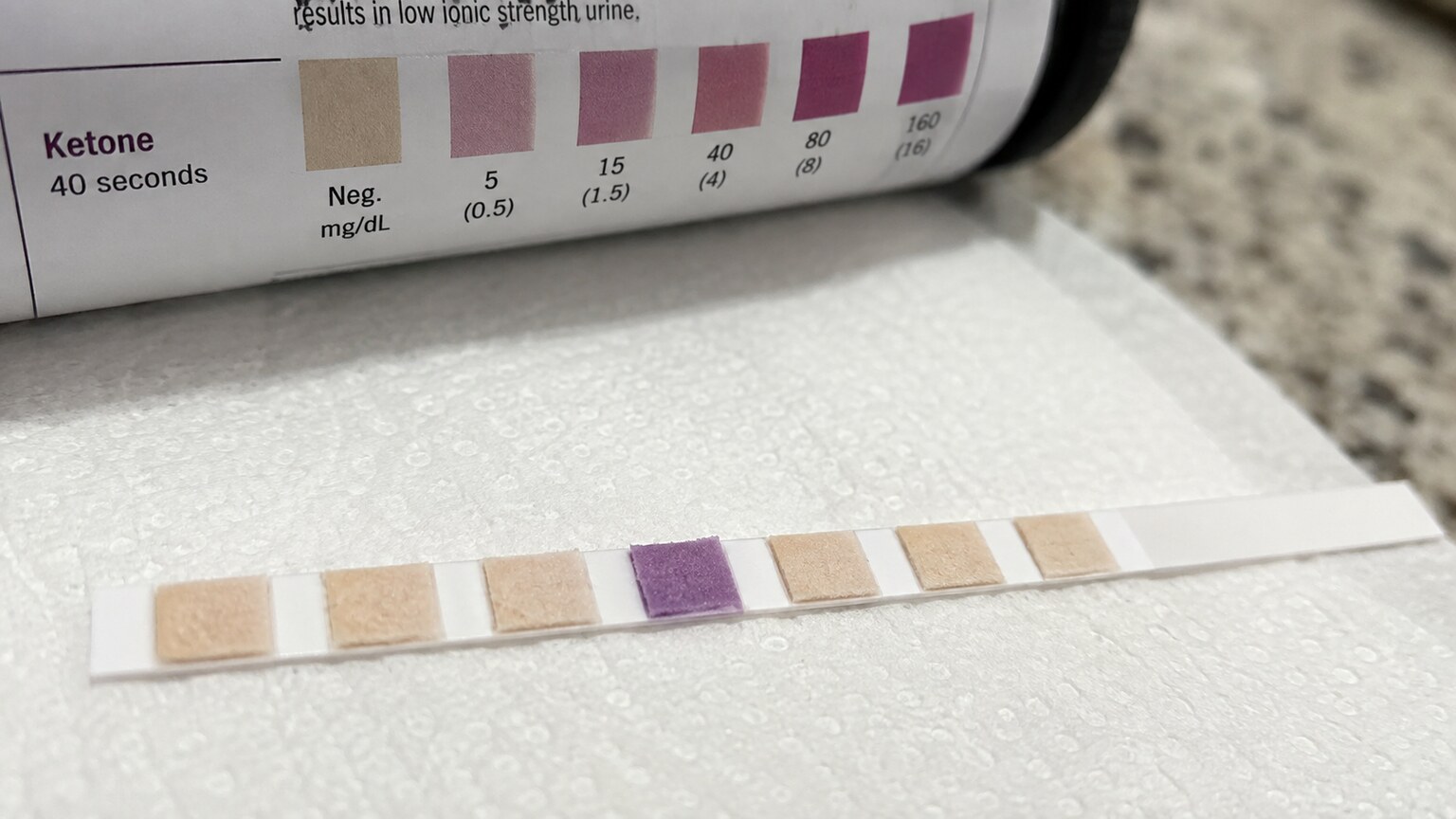 Close-up of a urine test strip with its ketone reagent pad showing a purple color change indicating a positive result